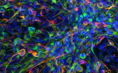 pediatric brain tumor